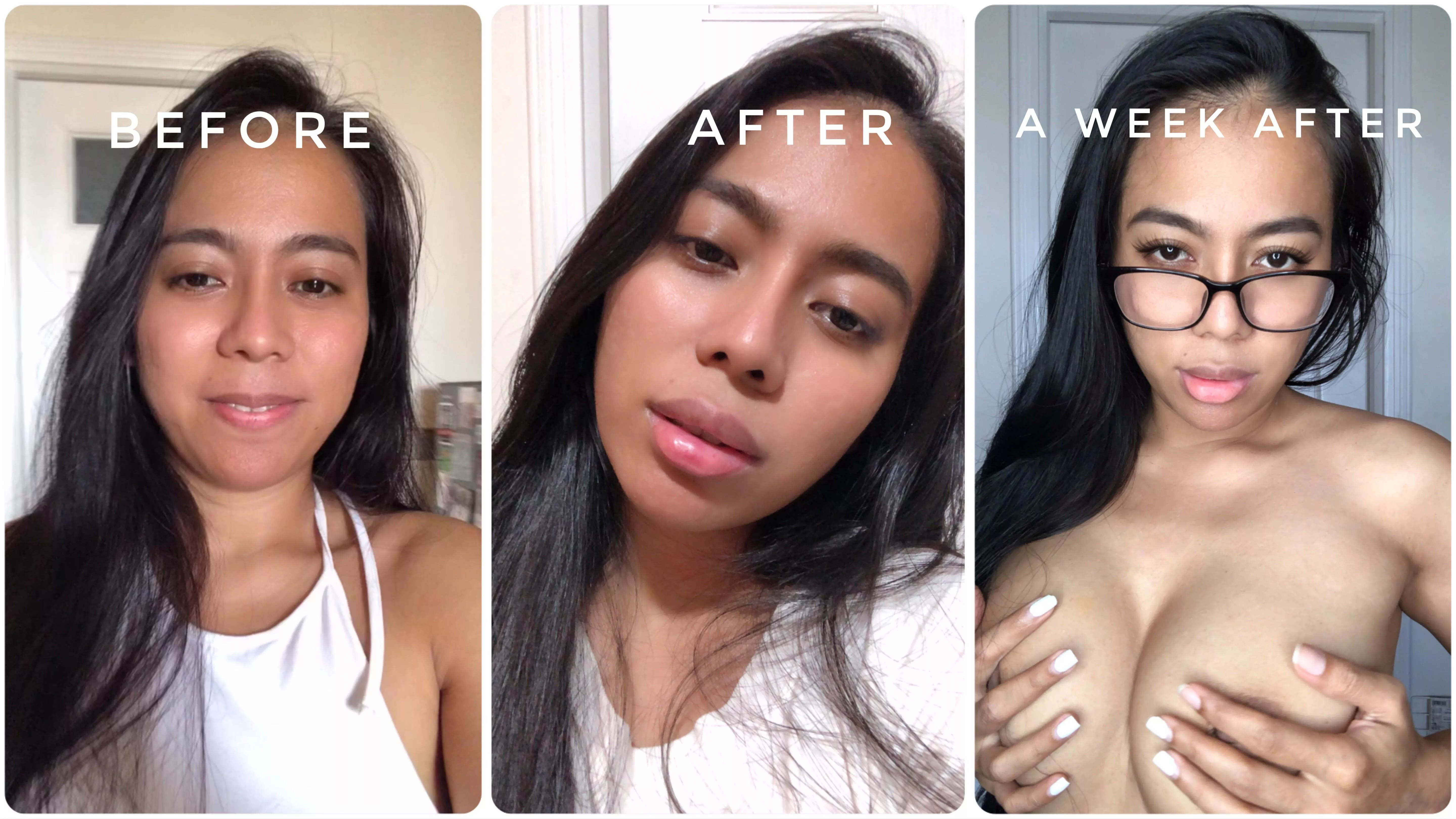 Bimbo journey update: A generous supporter funded my first ever round of lip fillers! I’m sooo over the moon!! 😍🥰💕How do I look? ;)