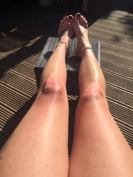 Blue Sky Blue Toes โ๏ธ๐โบ๏ธ