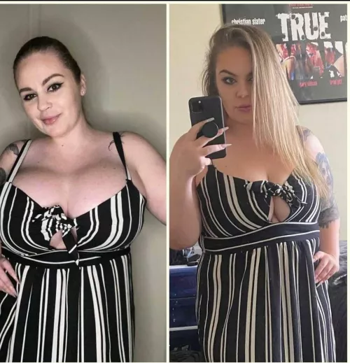 Boobs srugery should be an obligatory thing