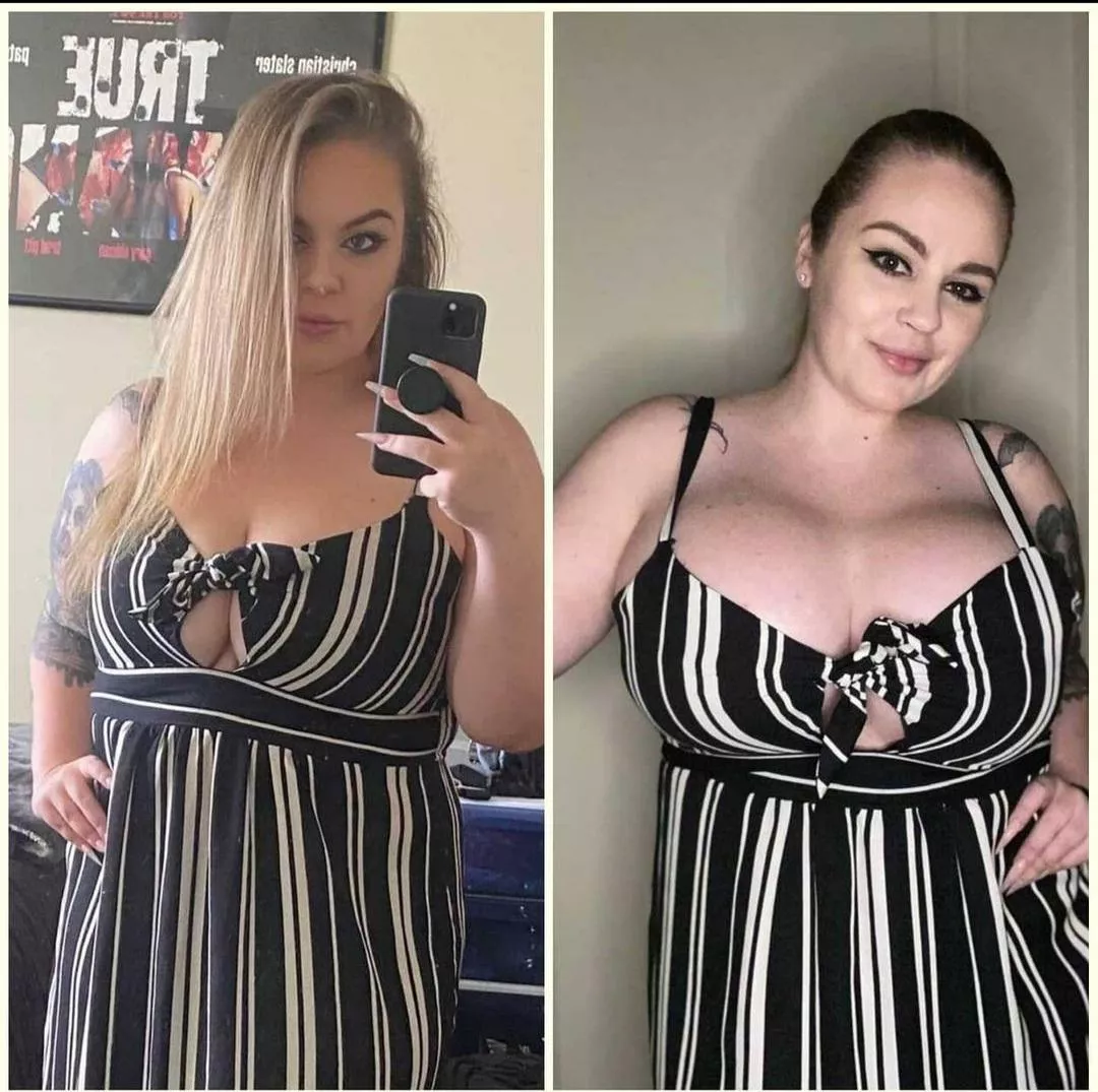 Boobs surgery should be an obligatory thing Boobs surgery should be an obligatory thing