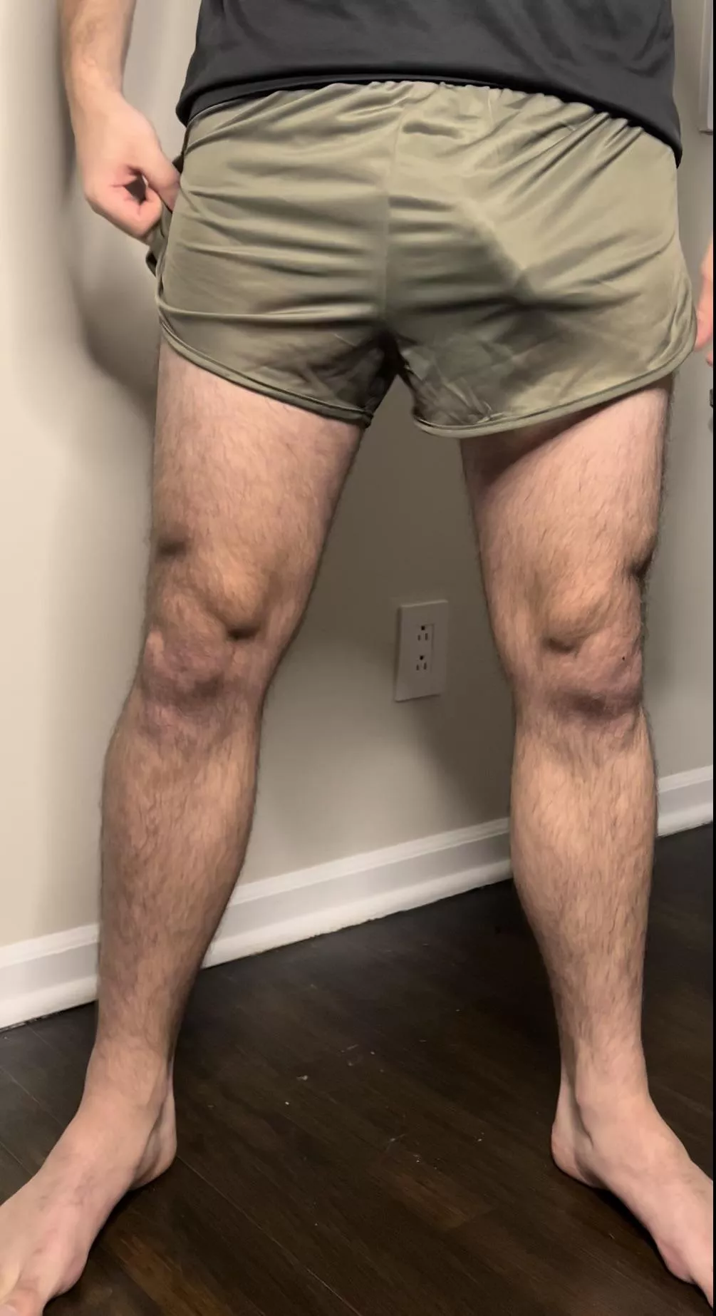 Bulging in silkies