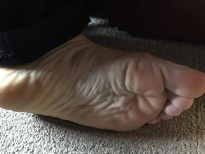 Can you count the wrinkles?
