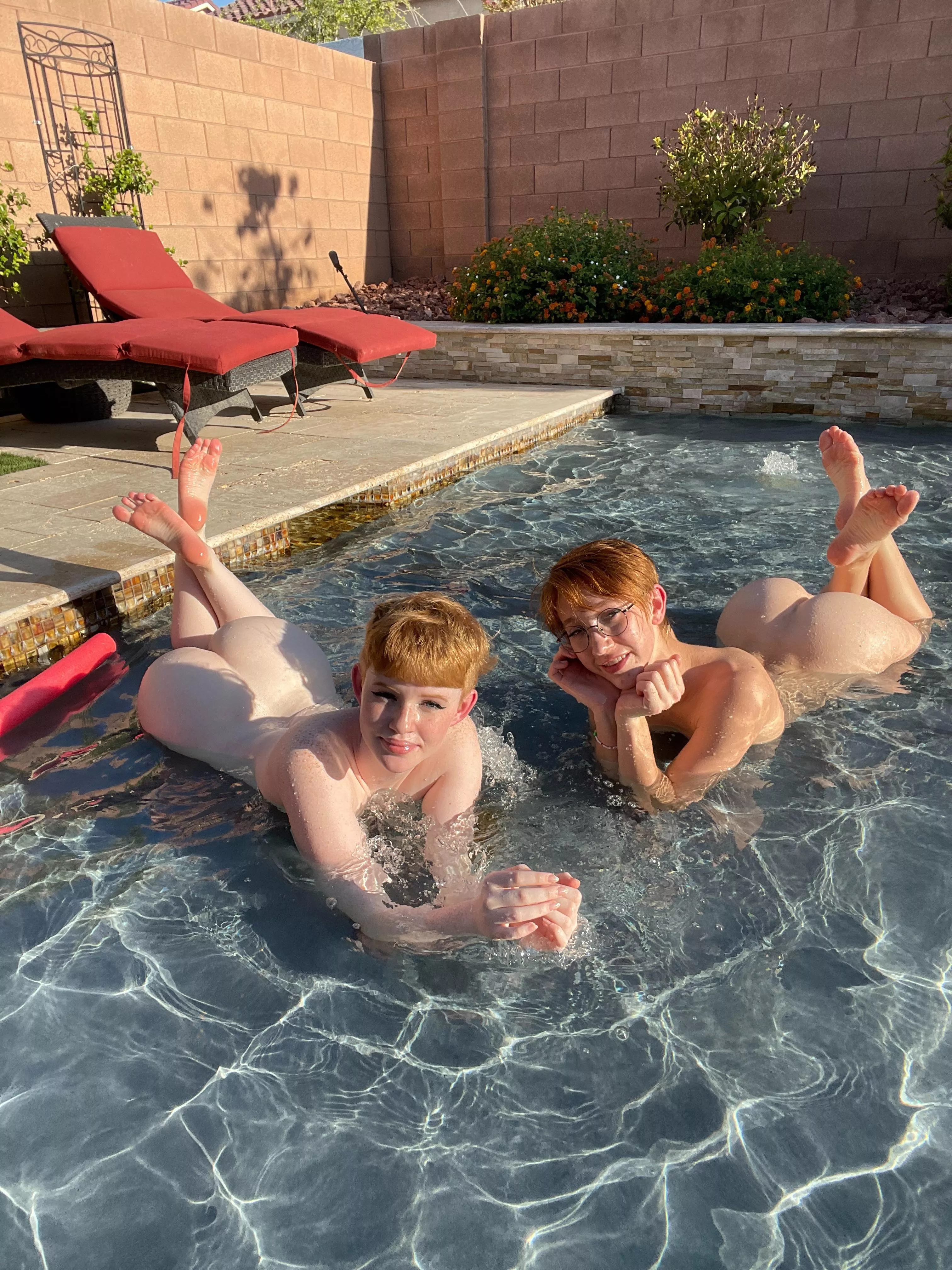 Can you guess who has more freckles? Can you guess who has more freckles?