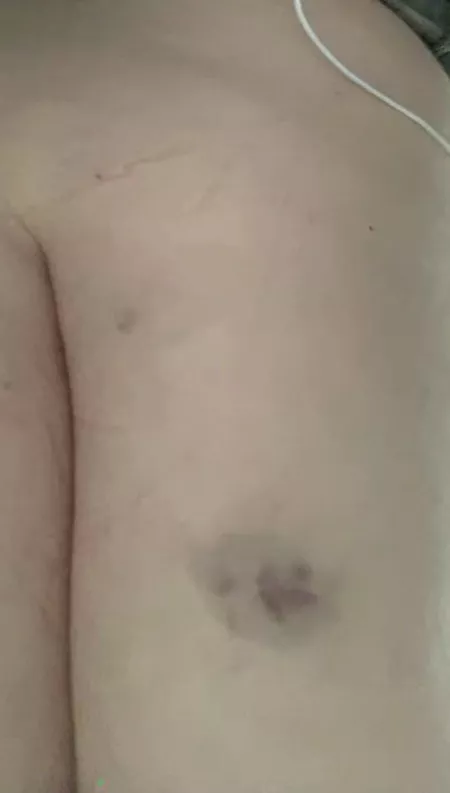 Cane mark