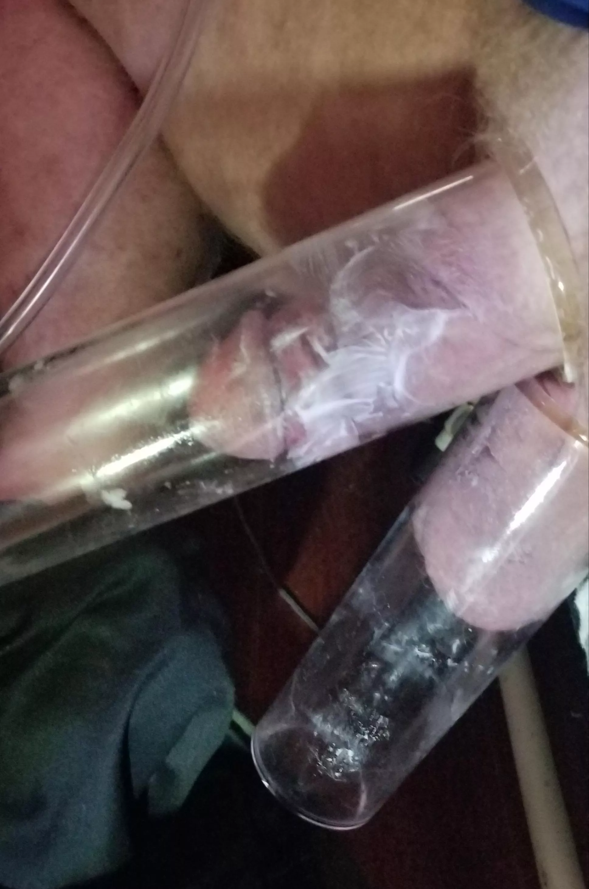 Can't speak for everyone. This was difficult to accomplish and uncomfortable when I got it to work. 😔