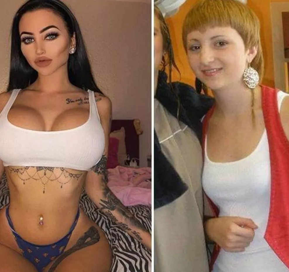 @Ccentino Celine Centino before & after %¯ perfec.t Insta: @GodTierPlastic @Ccentino Celine Centino before & after %¯ perfec.t Insta: @GodTierPlastic