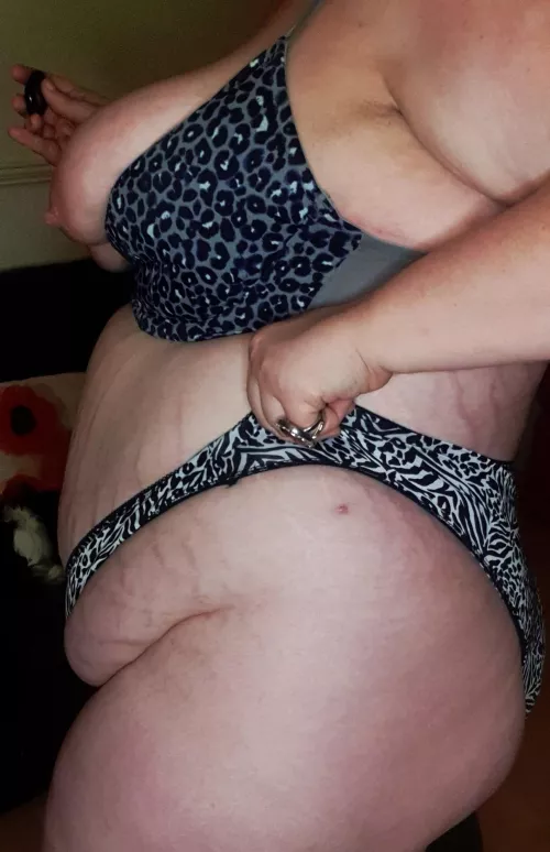 Cellulite and stretchmarks Cellulite and stretchmarks