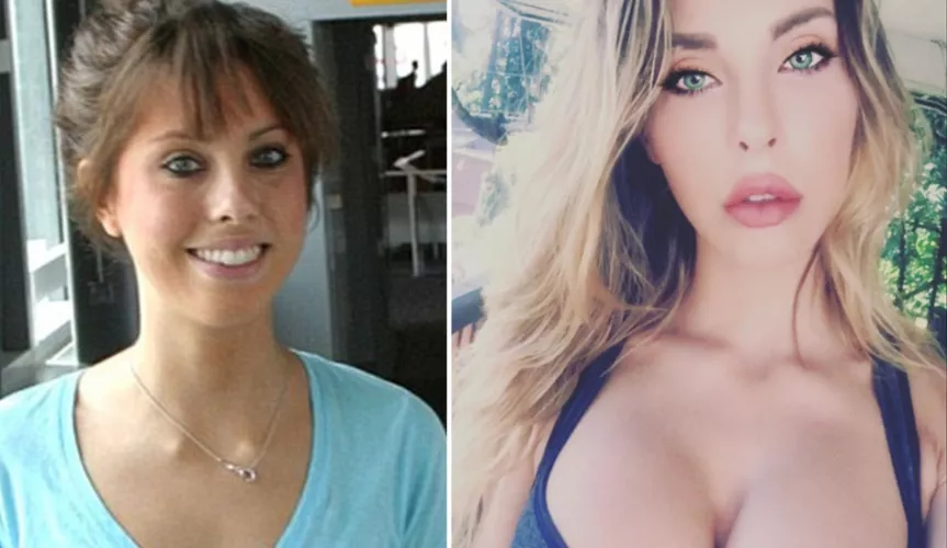 Chloe Lattanzi (duaghter of Olivia Newton-John) admits to having plastic surgery