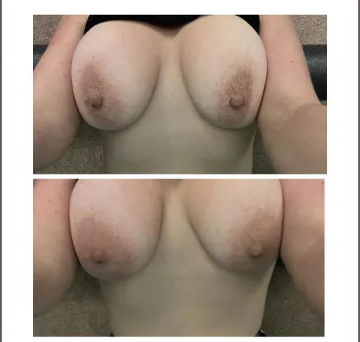 Cold vs warm areolas! Cold vs warm areolas!