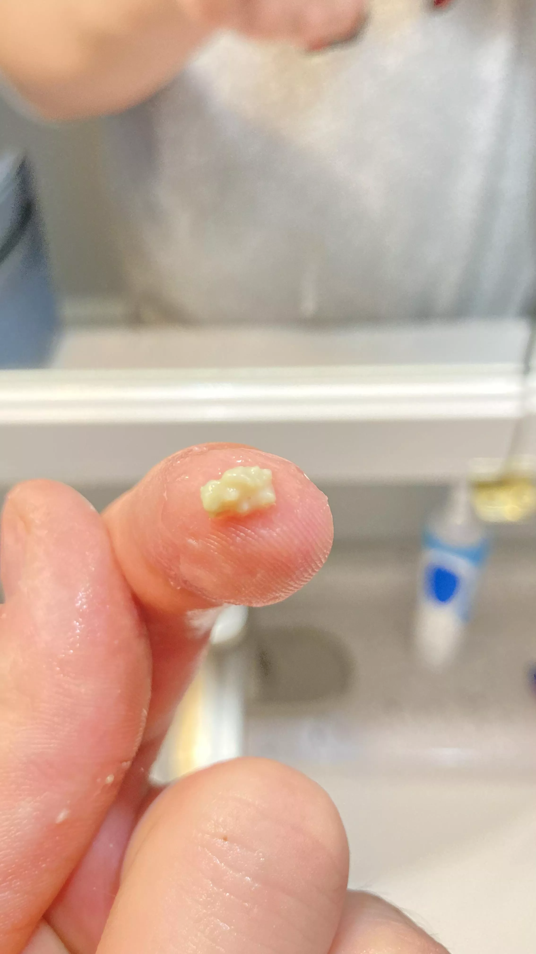 Coughed this sucker up