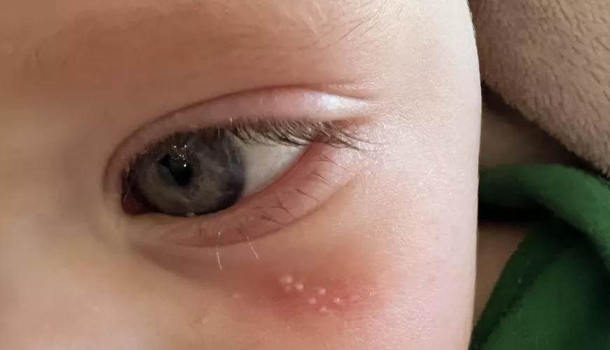 Daughter has forbidden pops and it is so very difficult to not mess with them.