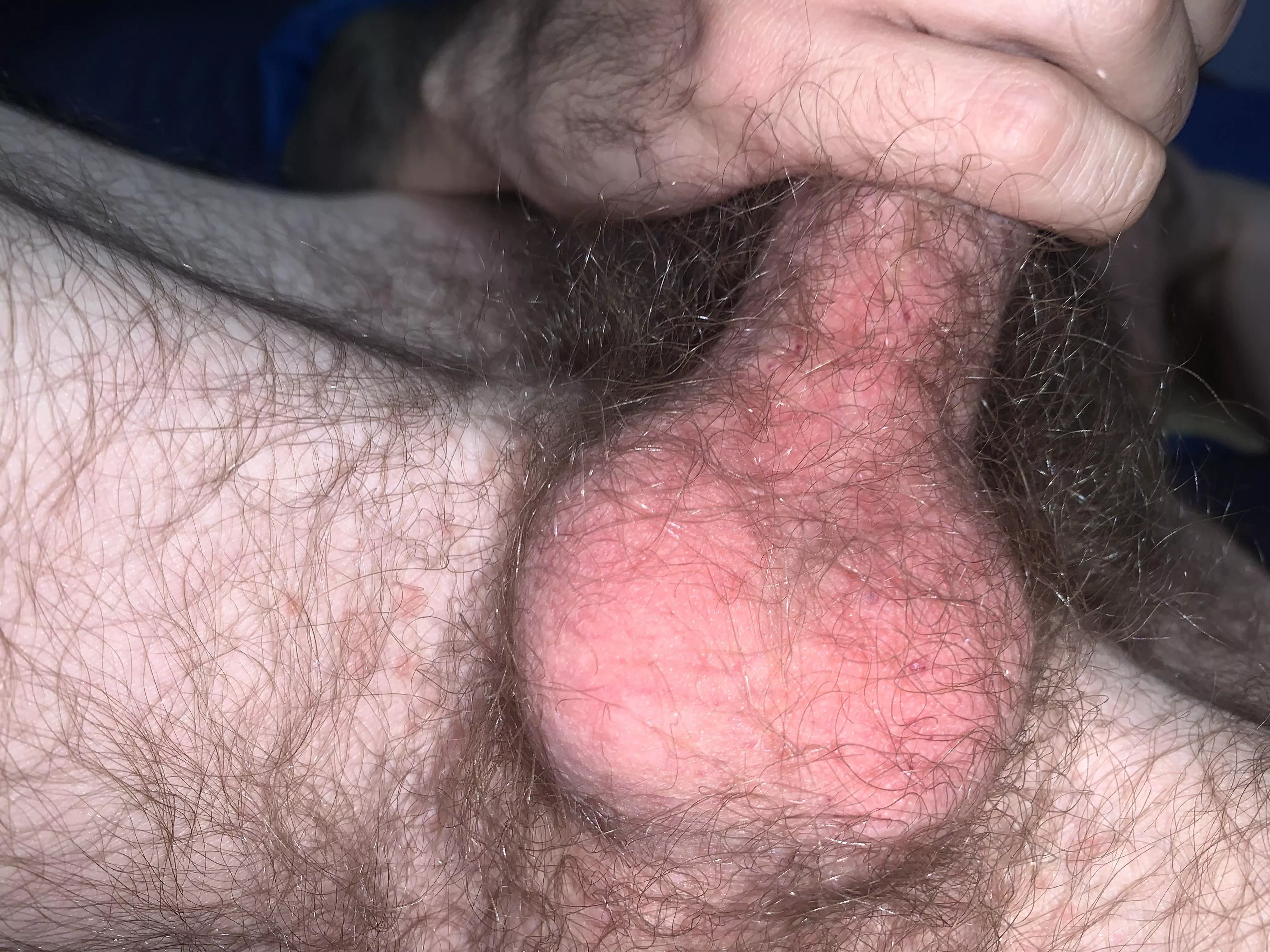 Dem nuts doe Dem nuts doe