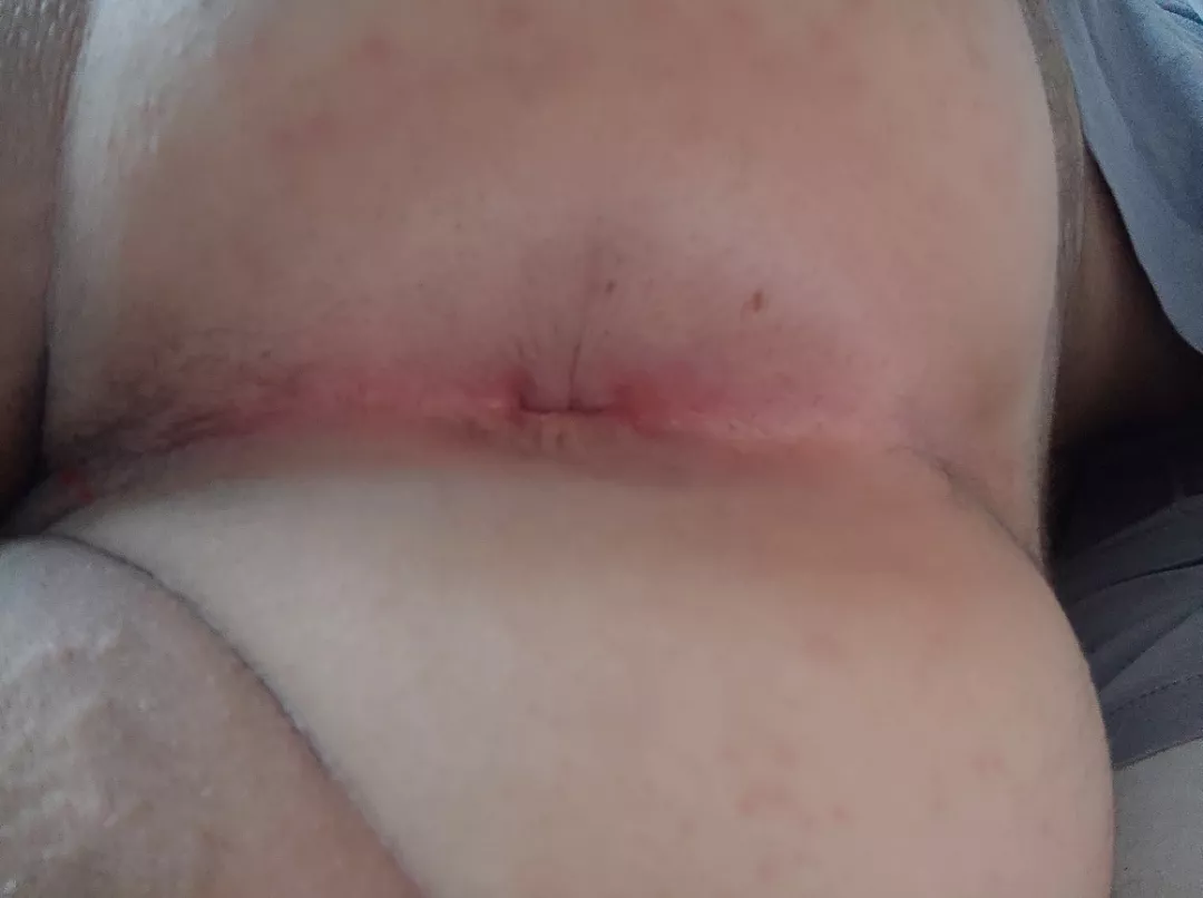 Dm