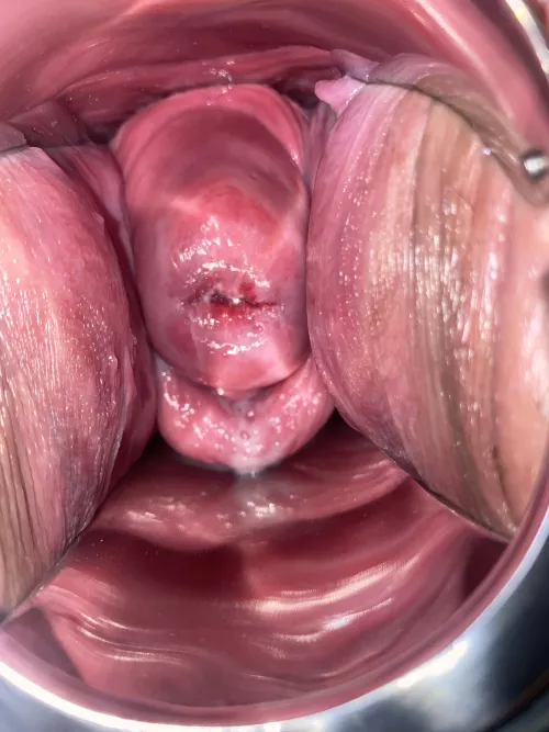 Do you enjoy seeing my swollen cervix after a hard fisting ?? Do you enjoy seeing my swollen cervix after a hard fisting ??