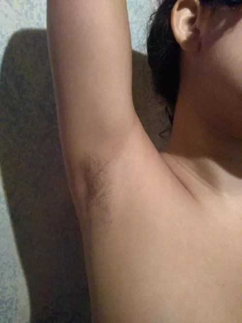 Do you have an advice to this girl who's a bit insecure about body hair? ๐