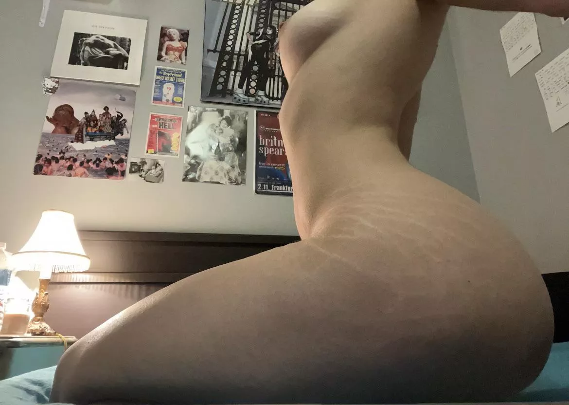 Do you like a girl with stretch marks ? Do you like a girl with stretch marks ?