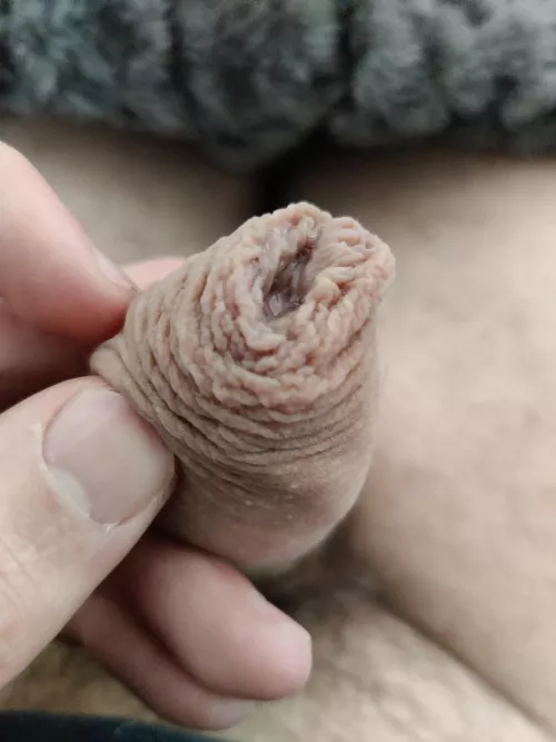 Do you like my foreskin? :)