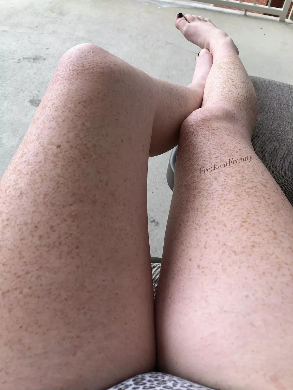 Do you like my freckles? Do you like my freckles?