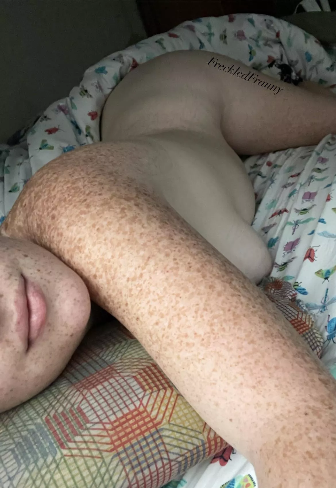 Do you like my freckles?