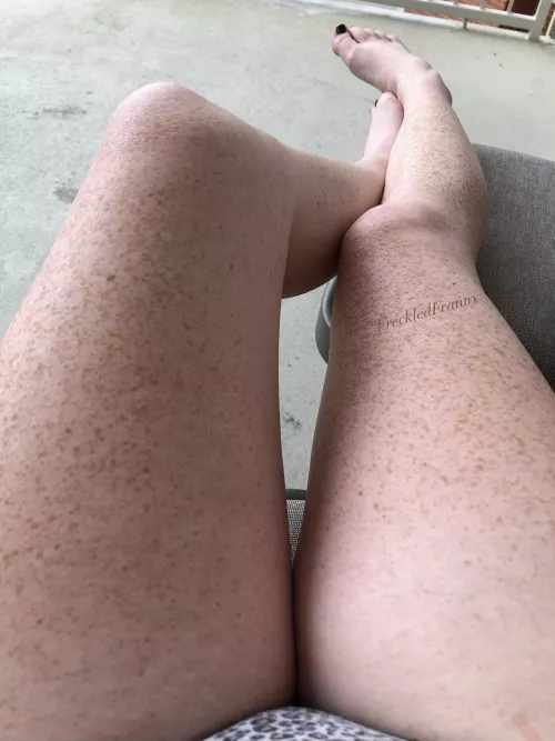 Do you like my freckles?
