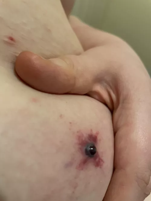 Does anyone else gets blood spots(?)