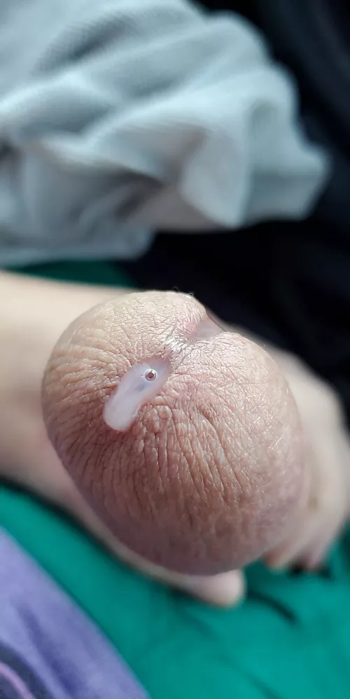 Does edging count?