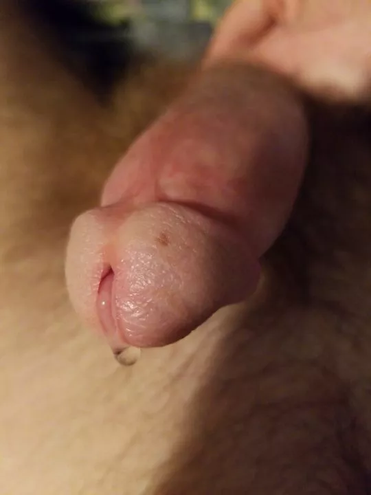 Dripping so much, can you help me? Dripping so much, can you help me?