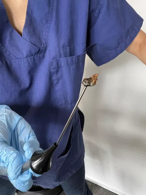 Ear wax from one ear.Ear specialist said it was 10/10 worst she’s seen.