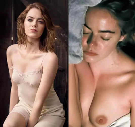 Emma Stone