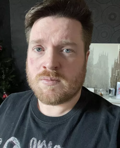 Everyone is so hot on here and then thereโs just me โ๐ผ๐ Everyone is so hot on here and then thereโs just me โ๐ผ๐