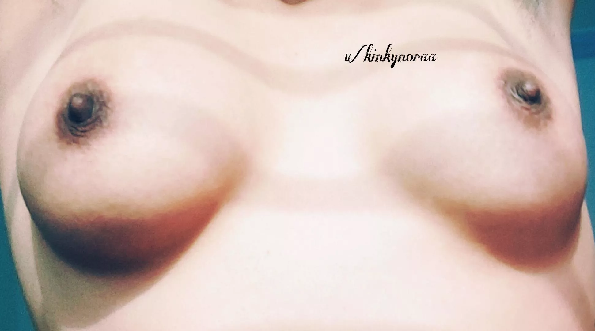 [F] Which one will you press?