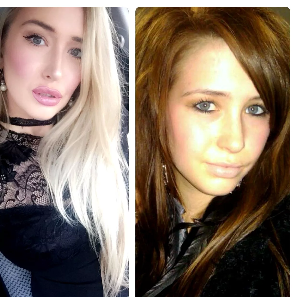 Facial b7mbofication progress???