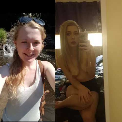 Feel like a new girl aws booked for more filler this week but I haven't had enough shifts to cover the costs