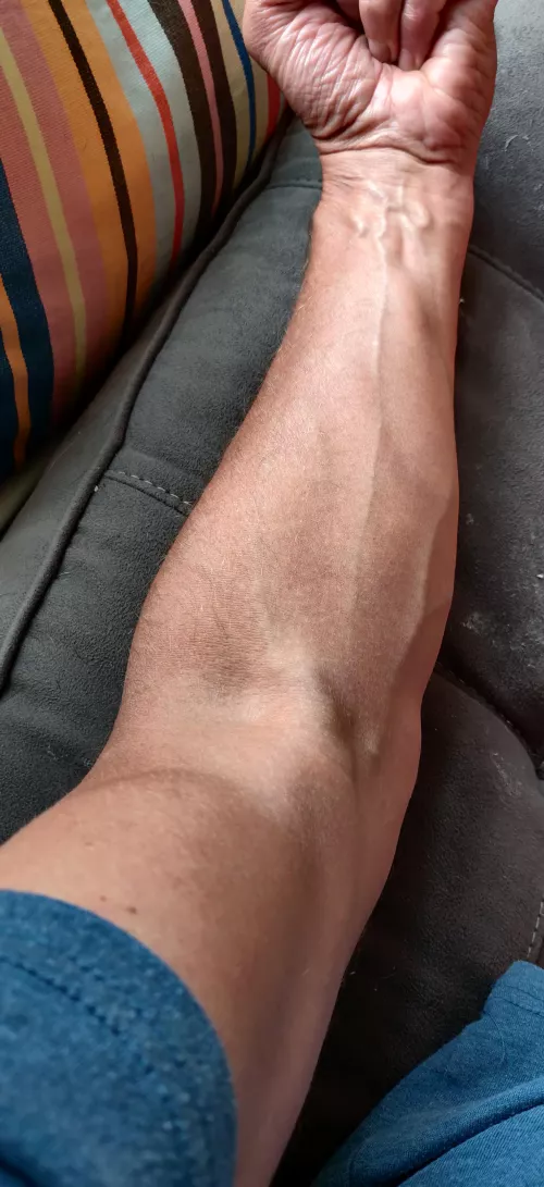 First time forearm First time forearm