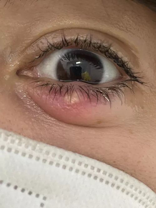 Forbidden (and quite painful) pop