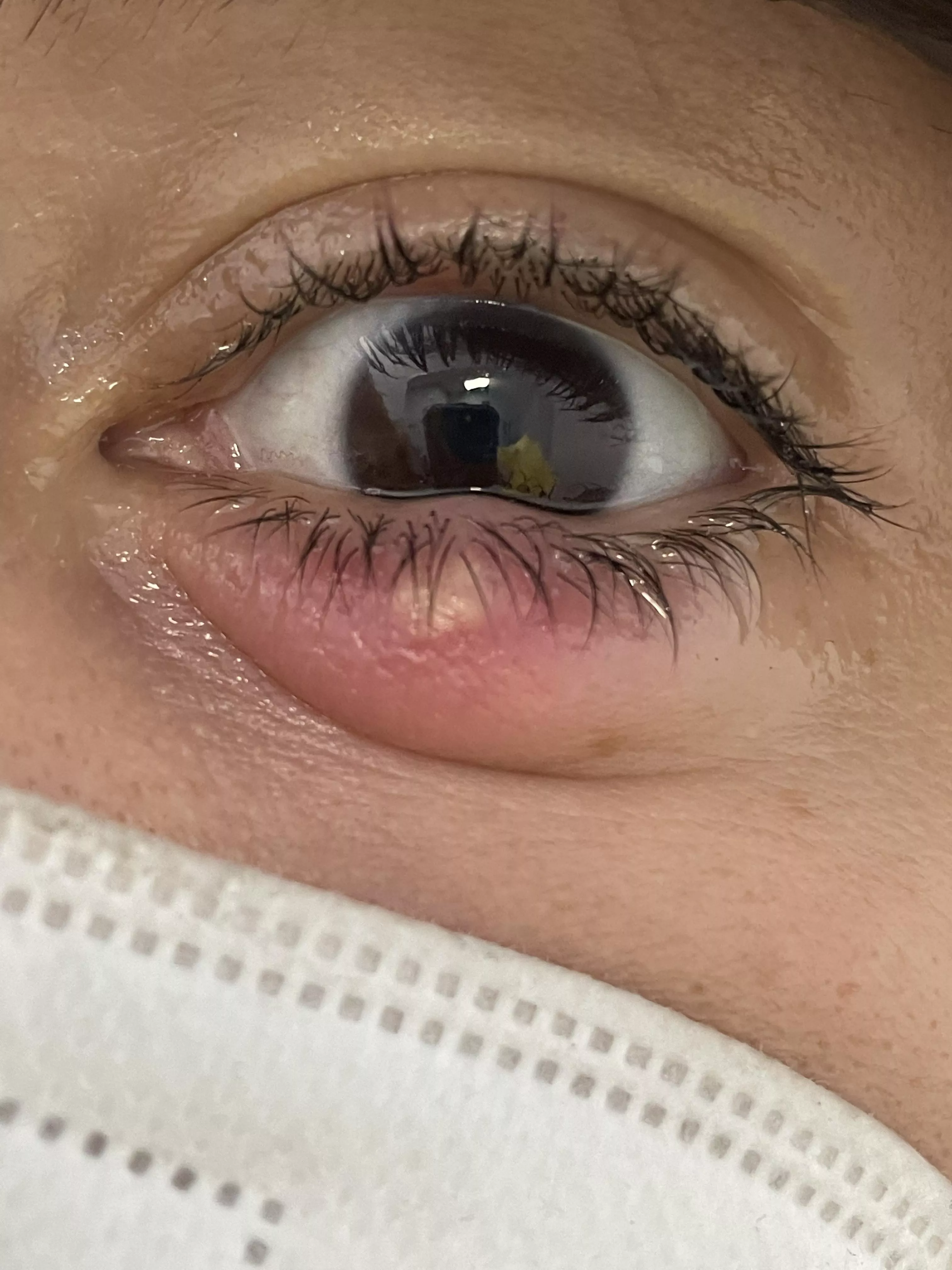 Forbidden (and quite painful) pop