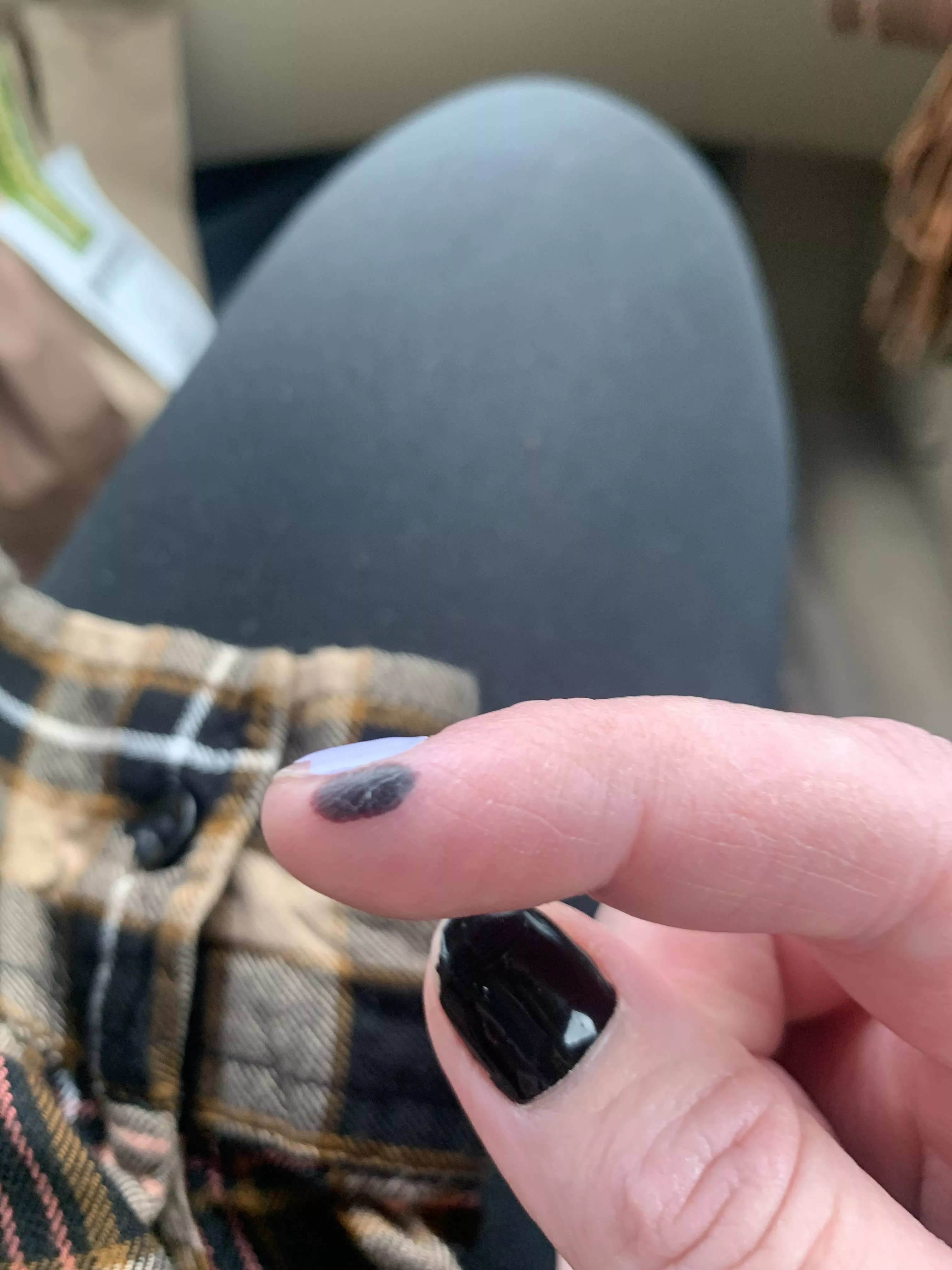 Forbidden pop. Blood blister. Quite dark.
