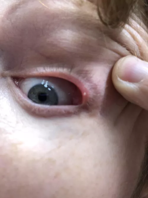 Forbidden pop that hurts like hellllllllllllllll.