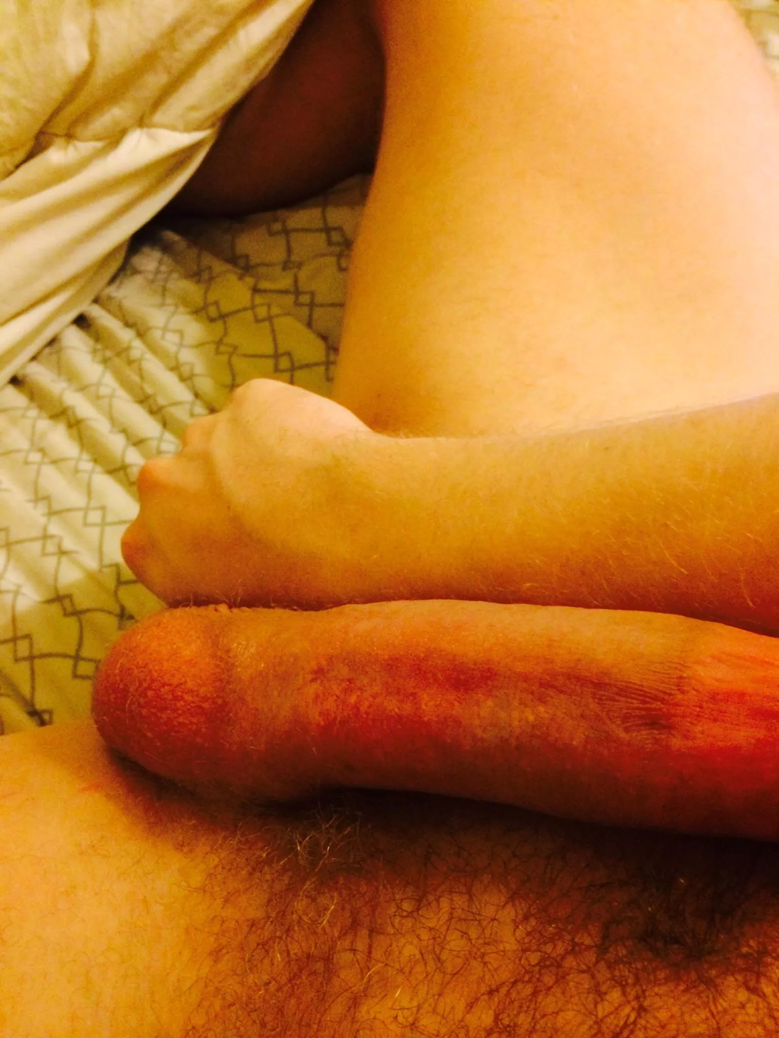 Forearm thick Forearm thick