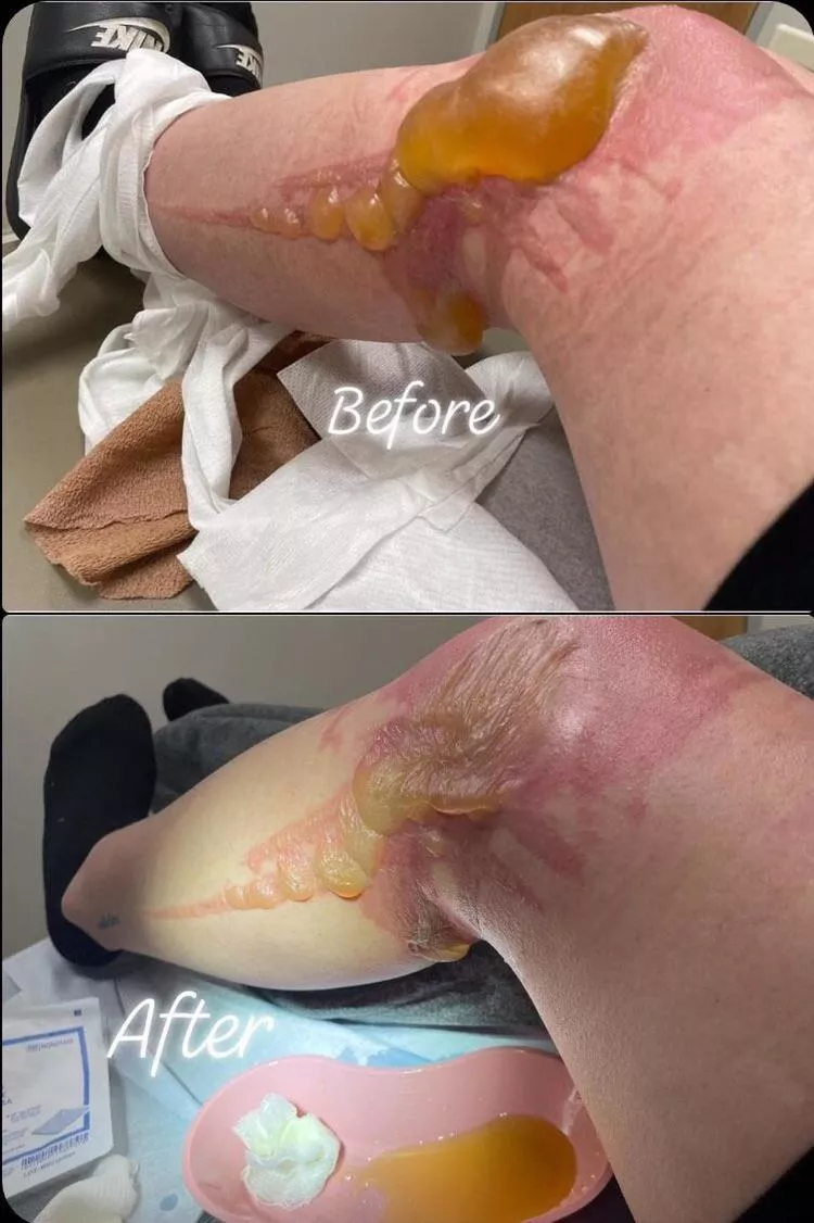 Found in a medical gore subreddit