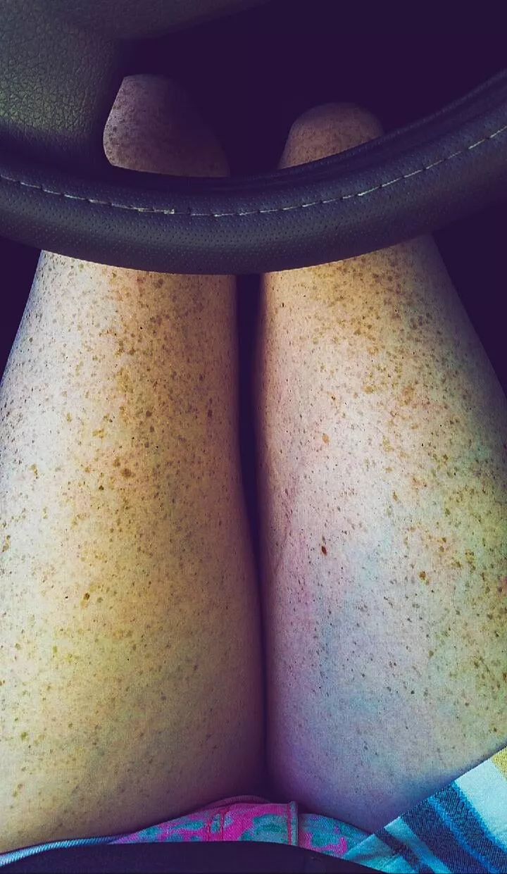 Freckle City Freckle City