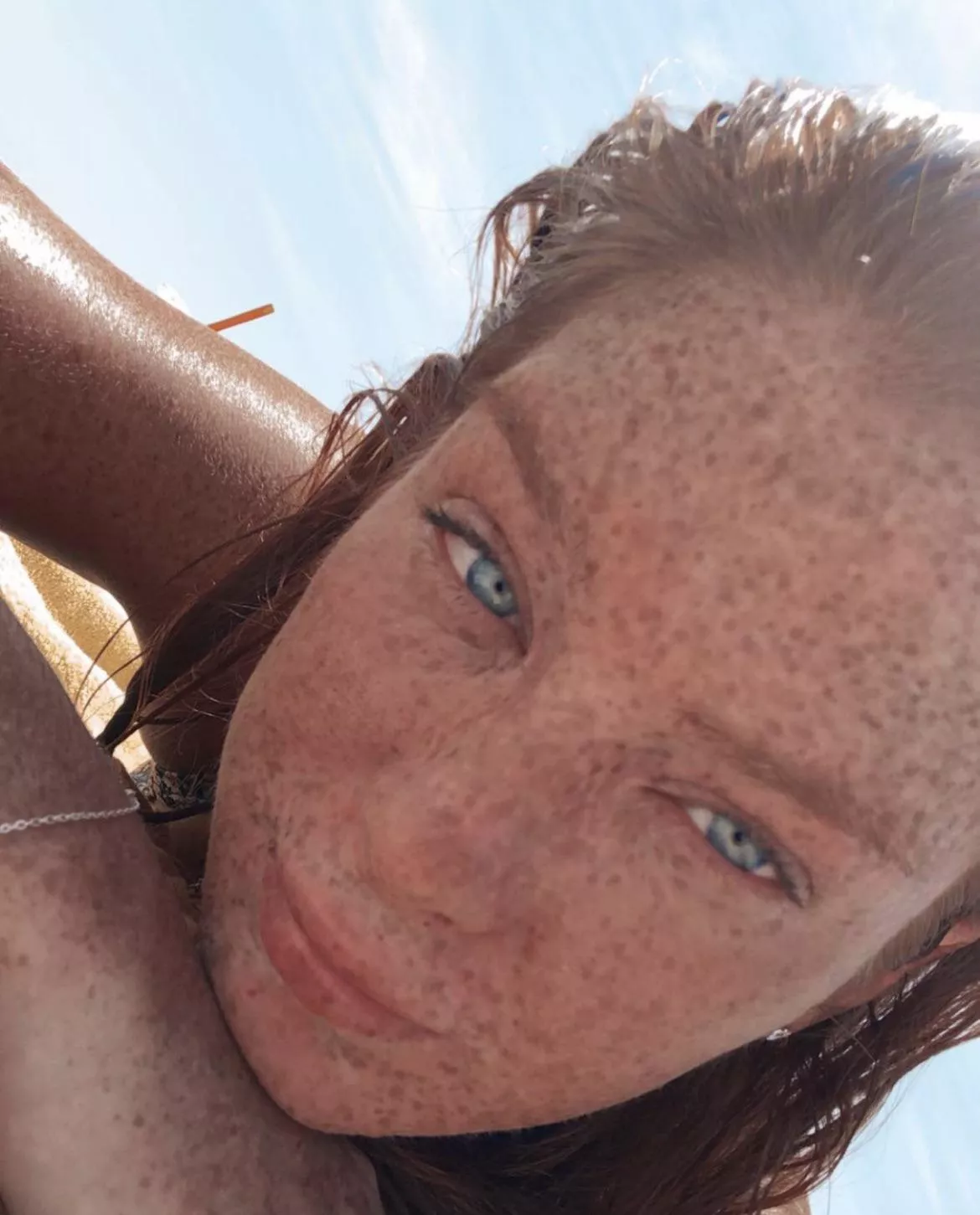Freckle Face Freckle Face