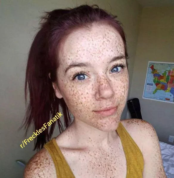 Freckles Porn Pics