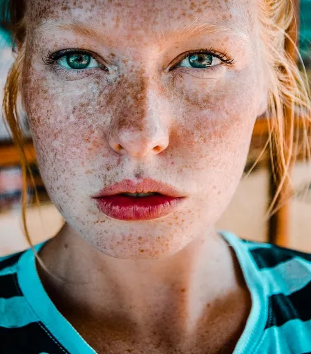 Freckles ā„ļø