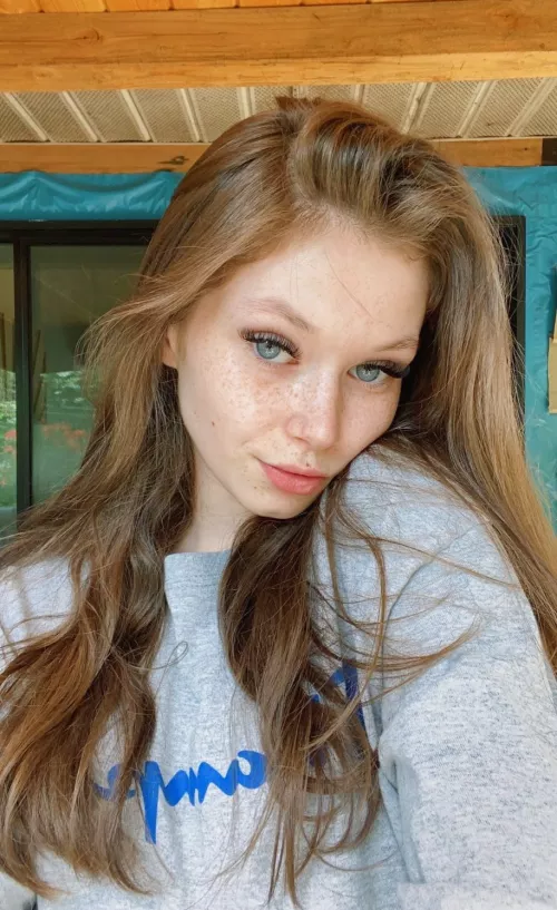 freckles freckles