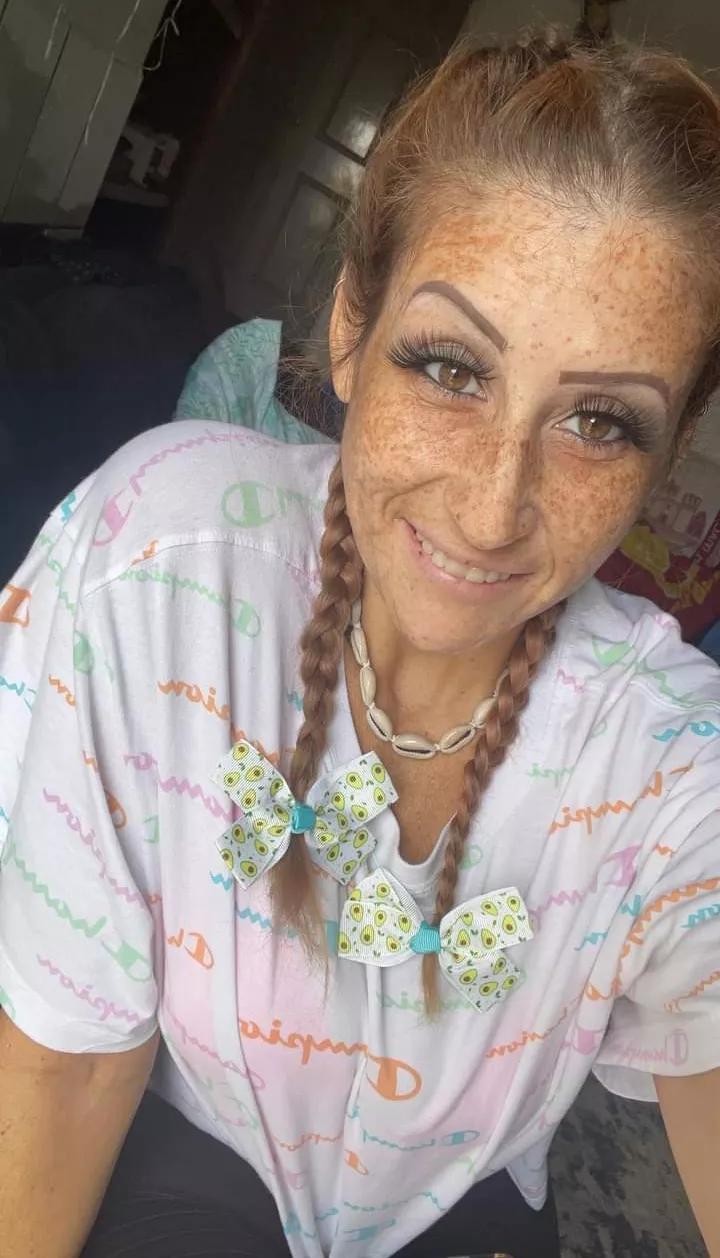 Freckles and pigtails ??