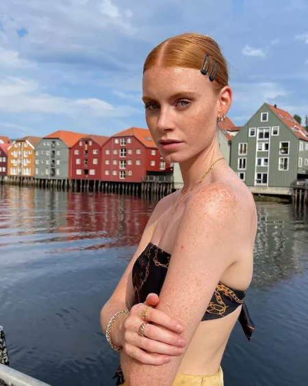 Freckles Ginger β₯οΈ