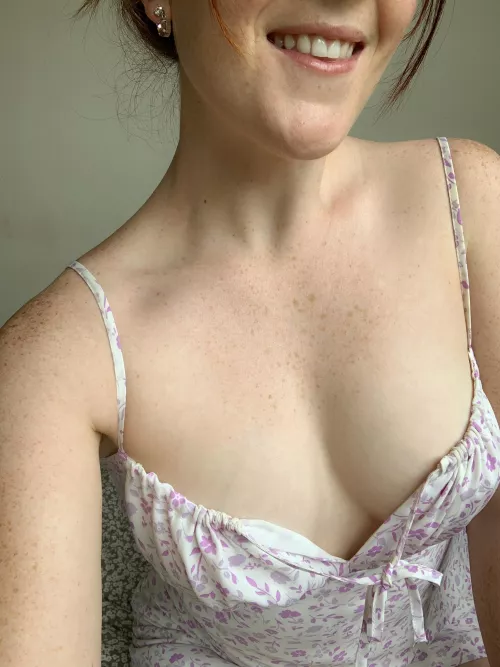 Freckles on the chest a big yes or a big no? F26