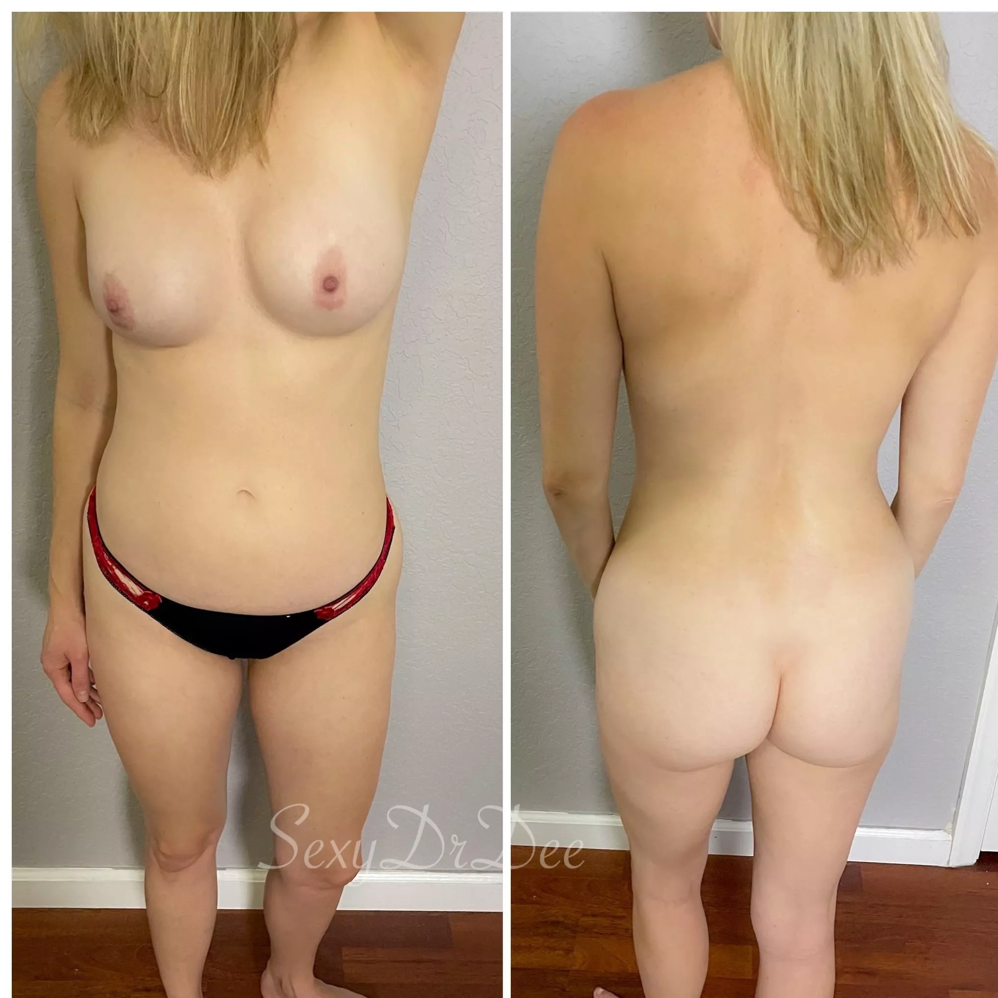 Front and back of my 35 year old mom bod Front and back of my 35 year old mom bod