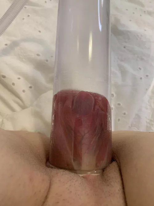 [ftm] i love how you can see my veins